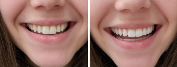 Stain Removing All Natural Toothpaste